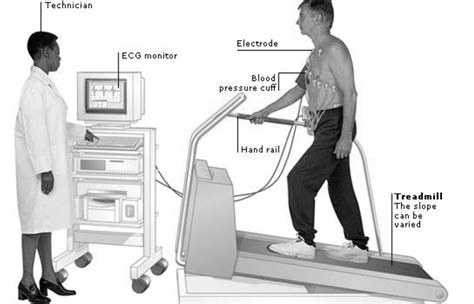 blood pressure drop during chemical stress test|blood pressure changes during stress testing.